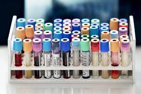 مجموعه ای از لوله های آزمایش خون در یک قفسه